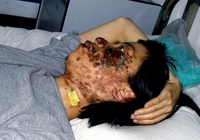 Лицо 36-летней Гао Жунжун было сильно обезображено пытками высоковольтными электрическими дубинками. Она умерла от пыток в 2005 году.