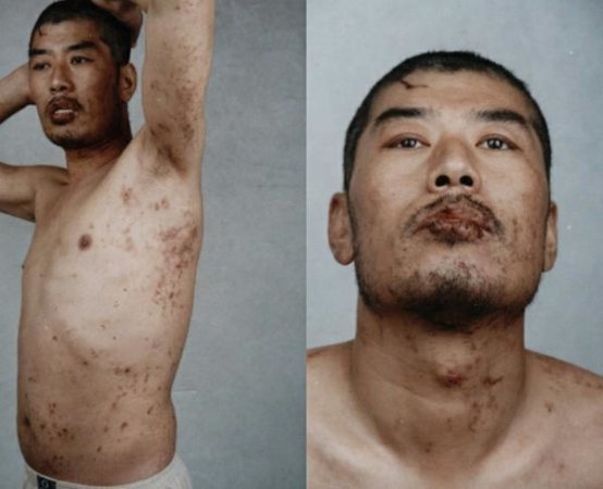 Фотографии Люй Давэя были сделаны через десять дней после того, как его пытали с применением электрических дубинок