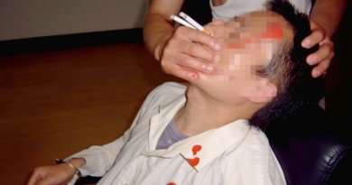 Воспроизведение метода пытки: зажжённые сигареты вставляют в ноздри жертвы, вынуждая втягивать дым через нос