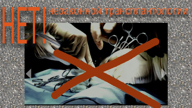 Нет незаконной трансплантологии