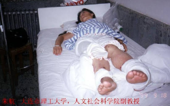 Доцент Чжу Хан из Политехнического университета Даляня была парализована и лишилась рассудка после пыток за практику Фалуньгун