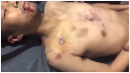 Очевидное подтверждение физического насилия: скриншот отдельных менее шокирующих кадров видео Пан Сюня.